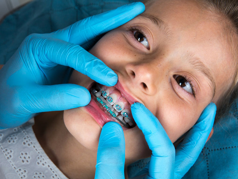 Orthodontics Children