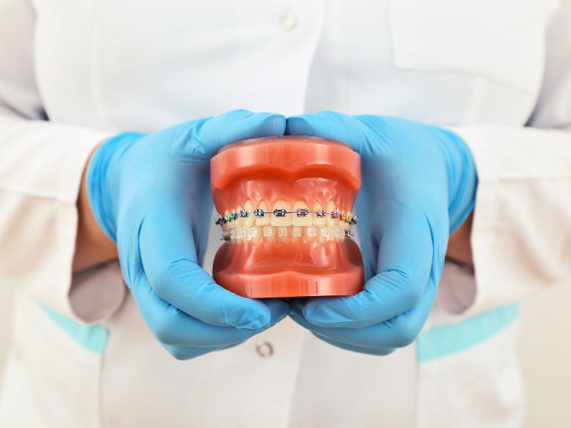 Questions for Orthodontist