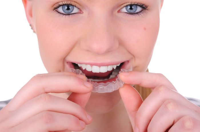 Invisalign for Adults